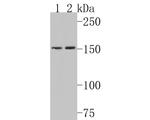 Collagen IV Antibody in Western Blot (WB)