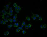 TSC1 Antibody in Immunocytochemistry (ICC/IF)