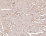 TSC1 Antibody in Immunohistochemistry (Paraffin) (IHC (P))