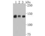 TSC1 Antibody in Western Blot (WB)