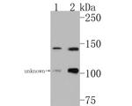 TSC1 Antibody in Western Blot (WB)