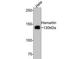 TSC1 Antibody in Western Blot (WB)