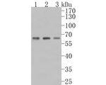 PIP5K1A Antibody in Western Blot (WB)