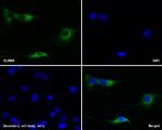 CLCNKB Antibody in Immunocytochemistry (ICC/IF)