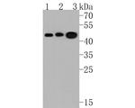 Kallikrein 11 Antibody in Western Blot (WB)