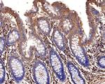 D4-GDI Antibody in Immunohistochemistry (Paraffin) (IHC (P))