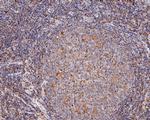 D4-GDI Antibody in Immunohistochemistry (Paraffin) (IHC (P))