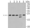 D4-GDI Antibody in Western Blot (WB)