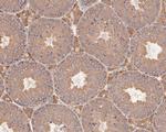 Presenilin 1 Antibody in Immunohistochemistry (Paraffin) (IHC (P))