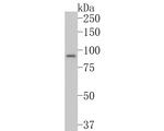 SKI Antibody in Western Blot (WB)