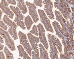 STRAP Antibody in Immunohistochemistry (Paraffin) (IHC (P))