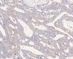 UCRC Antibody in Immunohistochemistry (Paraffin) (IHC (P))