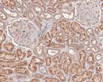 CER1 Antibody in Immunohistochemistry (Paraffin) (IHC (P))