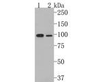 CLCN2 Antibody in Western Blot (WB)