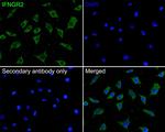 IFNGR2 Antibody in Immunocytochemistry (ICC/IF)