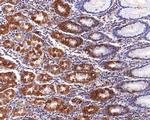 IFNGR2 Antibody in Immunohistochemistry (Paraffin) (IHC (P))