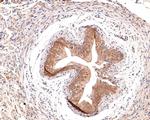 IFNGR2 Antibody in Immunohistochemistry (Paraffin) (IHC (P))