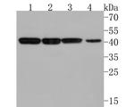 IFNGR2 Antibody in Western Blot (WB)