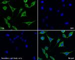 TTK Antibody in Immunocytochemistry (ICC/IF)