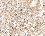 TTK Antibody in Immunohistochemistry (Paraffin) (IHC (P))