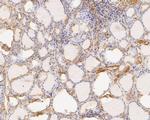 TTK Antibody in Immunohistochemistry (Paraffin) (IHC (P))