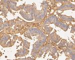 TTK Antibody in Immunohistochemistry (Paraffin) (IHC (P))