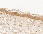 TTK Antibody in Immunohistochemistry (Paraffin) (IHC (P))