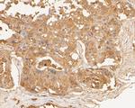 TTK Antibody in Immunohistochemistry (Paraffin) (IHC (P))