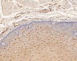 TTK Antibody in Immunohistochemistry (Paraffin) (IHC (P))