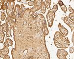 TTK Antibody in Immunohistochemistry (Paraffin) (IHC (P))