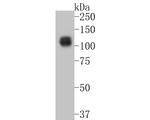 TTK Antibody in Western Blot (WB)