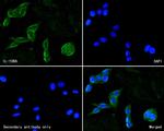 IL10RA Antibody in Immunocytochemistry (ICC/IF)