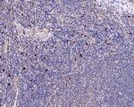 IL10RA Antibody in Immunohistochemistry (Paraffin) (IHC (P))