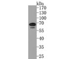 IL10RA Antibody in Western Blot (WB)