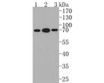 IL10RA Antibody in Western Blot (WB)