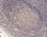 LEF1 Antibody in Immunohistochemistry (Paraffin) (IHC (P))