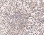 LEF1 Antibody in Immunohistochemistry (Paraffin) (IHC (P))