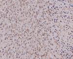 SLC25A37 Antibody in Immunohistochemistry (Paraffin) (IHC (P))