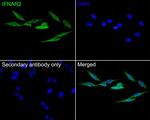 IFNAR2 Antibody in Immunocytochemistry (ICC/IF)