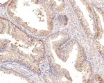 IFNAR2 Antibody in Immunohistochemistry (Paraffin) (IHC (P))