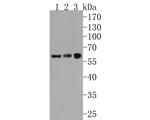 IFNAR2 Antibody in Western Blot (WB)