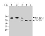 SLC22A2 Antibody in Western Blot (WB)