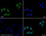 SOCS4 Antibody in Immunocytochemistry (ICC/IF)