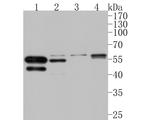 AMHR2 Antibody in Western Blot (WB)