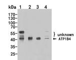 ATP1B4 Antibody in Western Blot (WB)