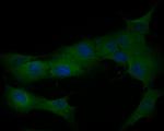 Cardiac Troponin C Antibody in Immunocytochemistry (ICC/IF)