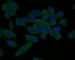 Cardiac Troponin C Antibody in Immunocytochemistry (ICC/IF)