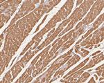 Cardiac Troponin C Antibody in Immunohistochemistry (Paraffin) (IHC (P))