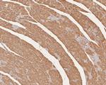 Cardiac Troponin C Antibody in Immunohistochemistry (Paraffin) (IHC (P))