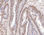 ONECUT3 Antibody in Immunohistochemistry (Paraffin) (IHC (P))